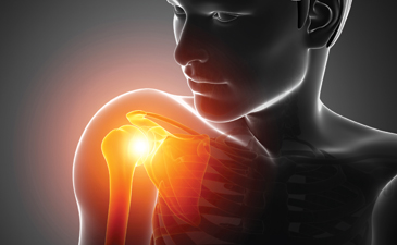 Ultrasound elastography probe design for diagnosing rotator cuff ...